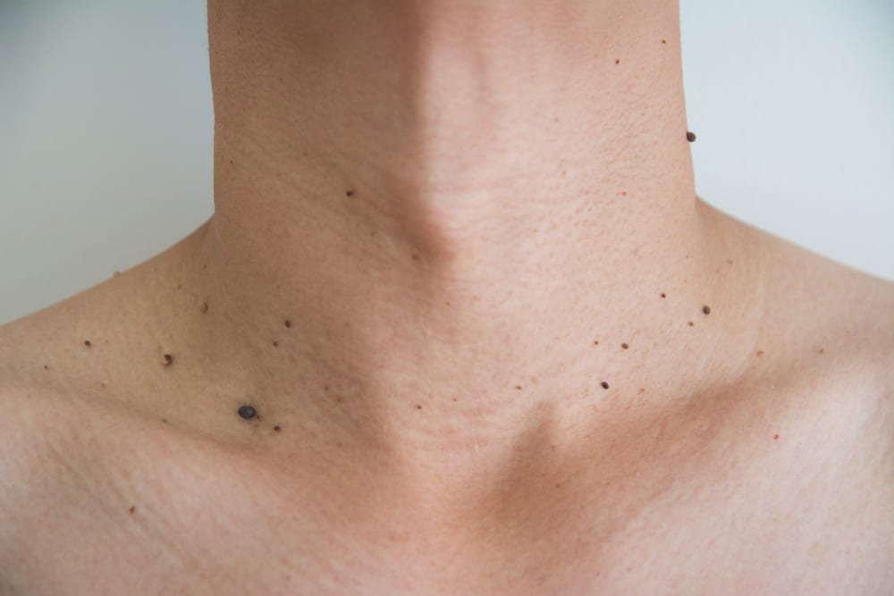 Dermatóloga clínica