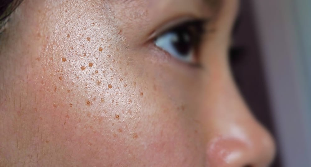 Dermatóloga clínica