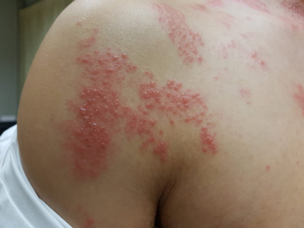 Dermatóloga clínica