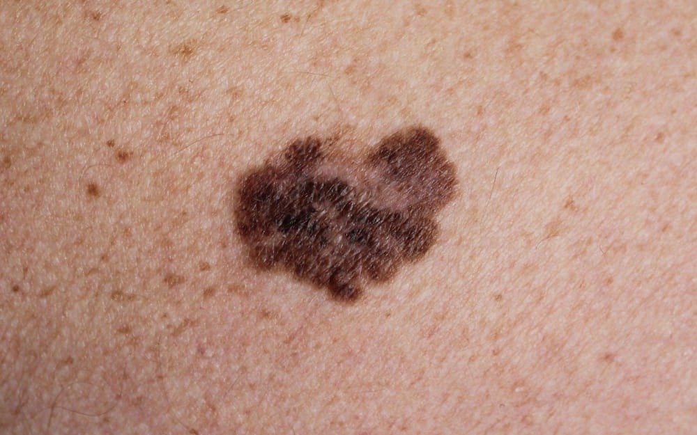 Dermatóloga clínica