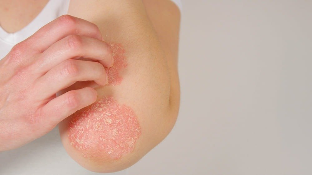 Dermatóloga clínica