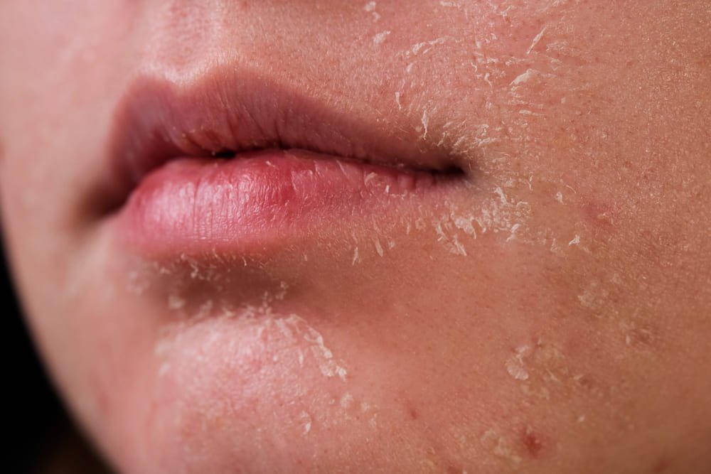 Dermatóloga clínica