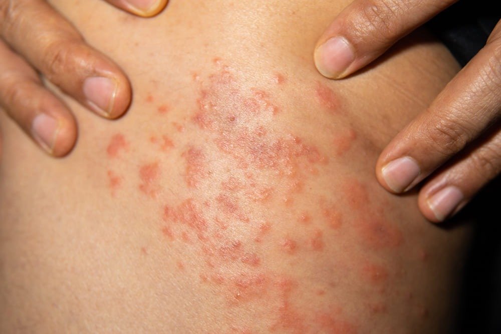 Dermatóloga clínica