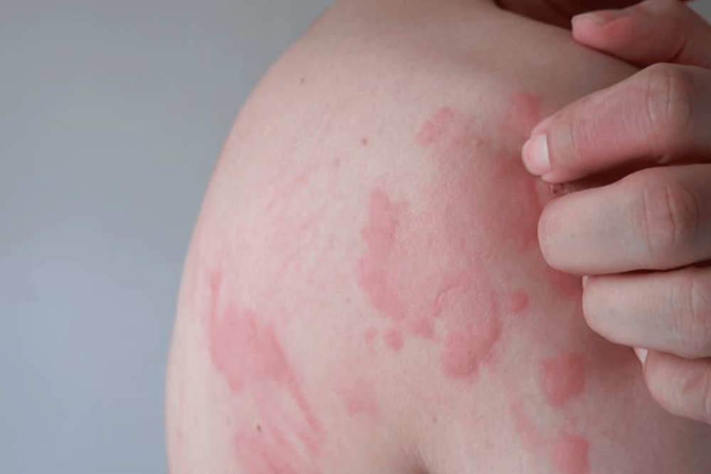 Dermatóloga clínica